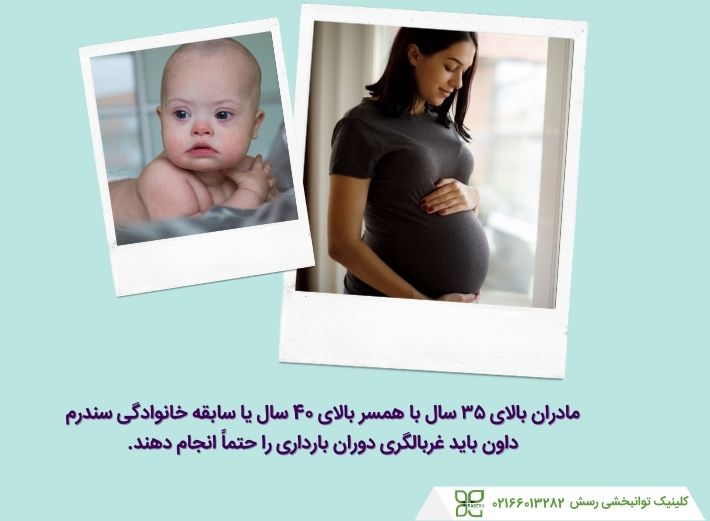 تأثیر سن مادر بر ابتلا به سندرم داون در نوزاد