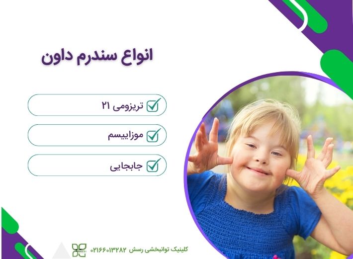 انواع سندرم داون
