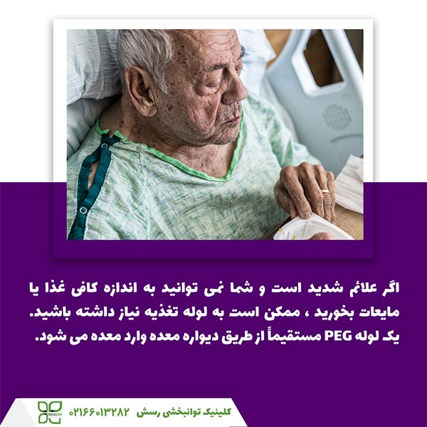 استفاده از لوله تغذیه برای بلع