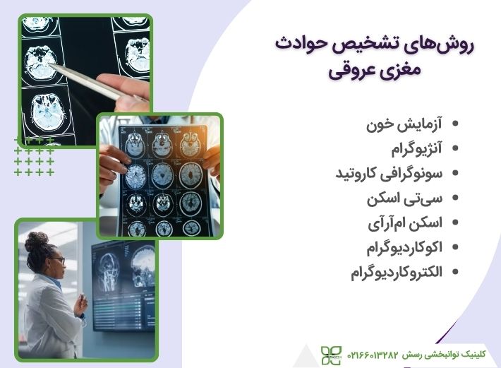تشخیص سکته مغزی