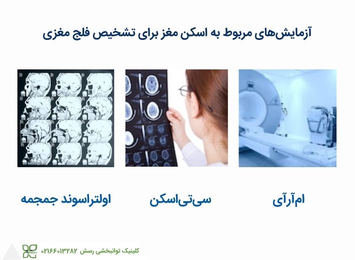 اسکن مغز به تشخیص فلج مغزی کمک می کند