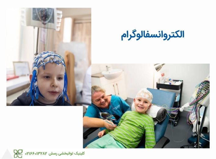 الکتروانسفالوگرام برای تشخیص فلج مغزی