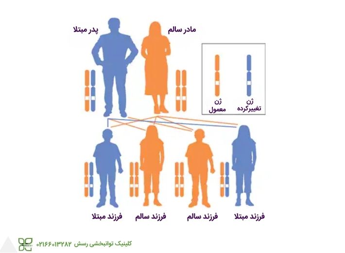 علت بیماری هانتینگتون 