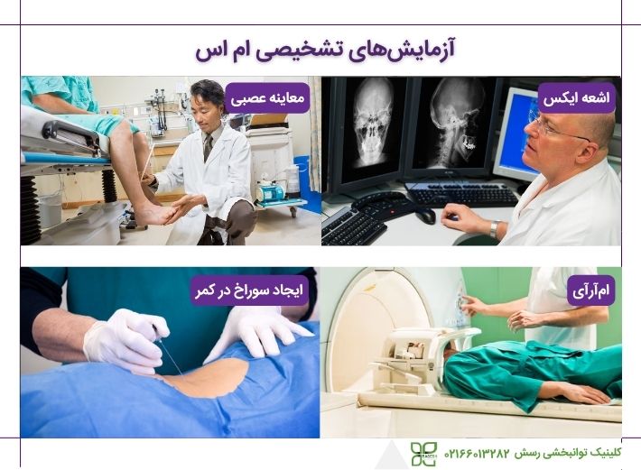 آزمایشی تشخیصی ام اس