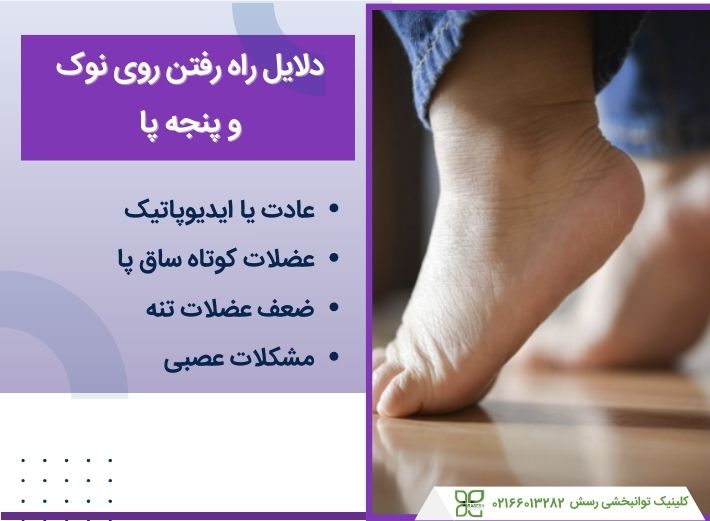 علت راه رفتن روی پنجه