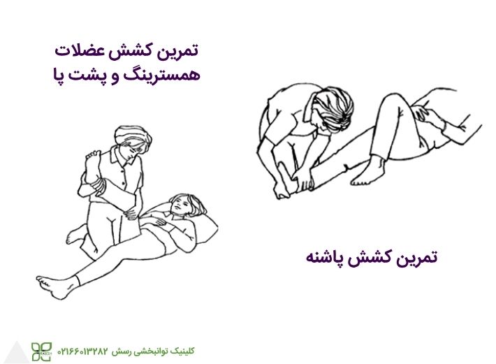 ورزشهای اصلاحی برای راه رفتن روی نوک پا