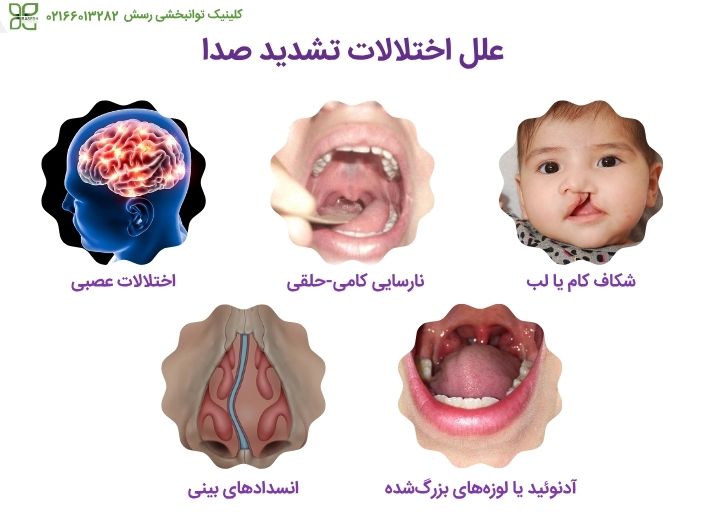 علت اختلال تشدید صدا