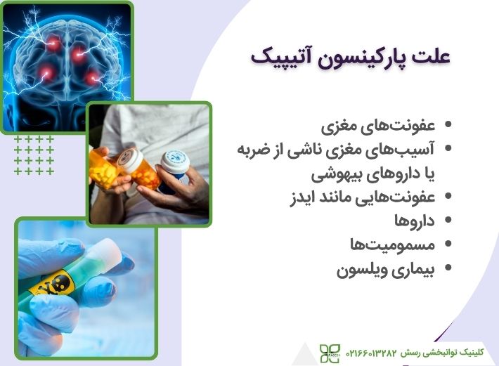 علت اختلالات پارکینسون آتیپیک