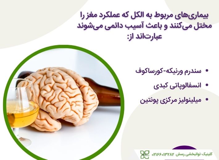 آسیب مغزی ناشی از الکل