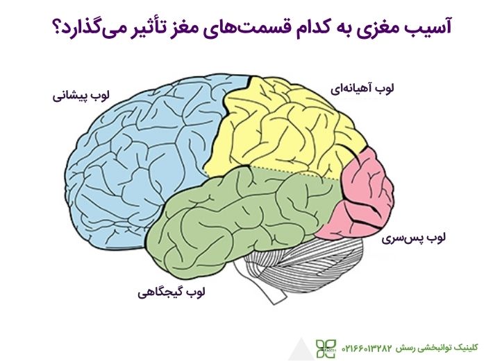 کدام قسمت های مغز دچار آسیب می شوند؟