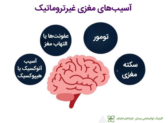آسیب های مغزی غیر تروماتیک