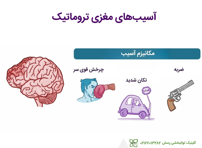 آسیب هاب مغزی تروماتیک