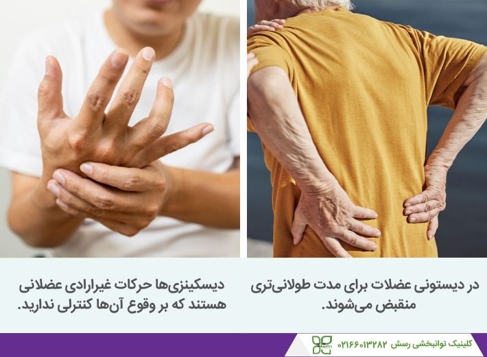 فرق دیستونی و دیسکینزی