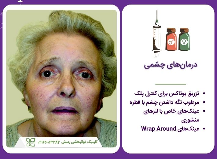 درمان های چشمی