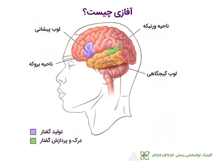 اختلال آفازی چیست؟