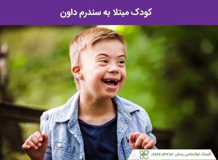 کودک مبتلا به سندرم داون