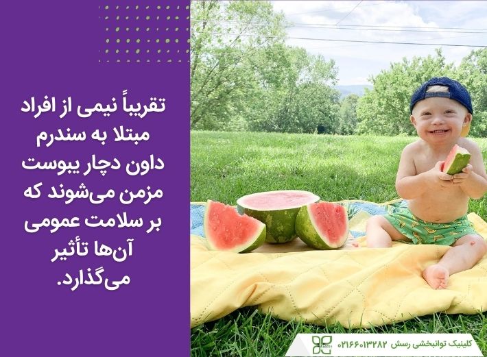 نیمی از افراد مبتلا به سندرم داون مشکل یبوست مزمن دارند