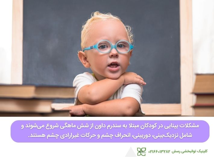 مشکلات بینایی در کودکان مبتلا به سندرم داون